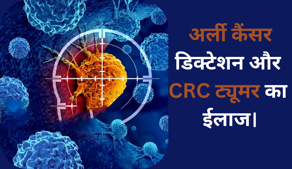 अर्ली कैंसर डिक्टेशन और CRC ट्यूमर का ईलाज।