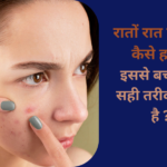 How to remove pimples overnight 2024 रातों रात पिंपल्स कैसे हटाए 2024, इससे बचने का सही तरीका क्या है।